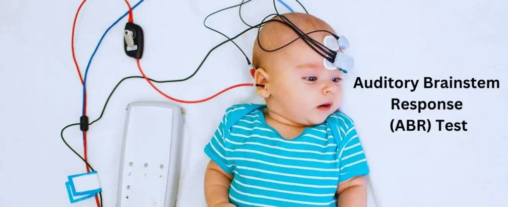 Auditory Brainstem Response (ABR) Test