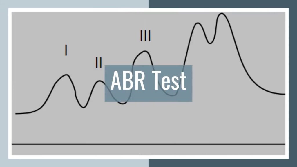 ABR Test